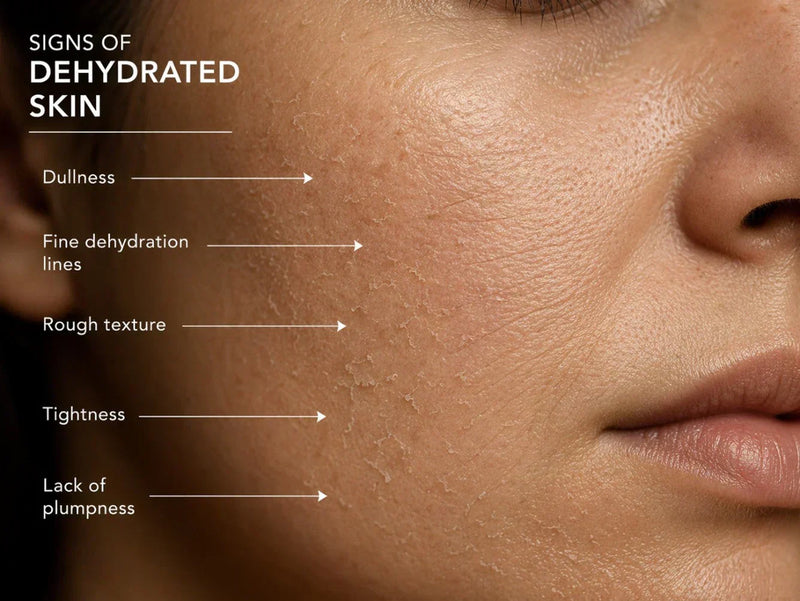 Hydration-first skincare article for long-term skin health and barrier support