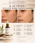 Serum Alchemy with Willow Bark