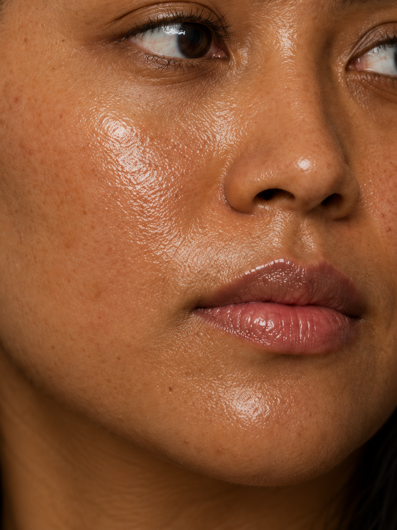 Oily/ Acne Prone Skin